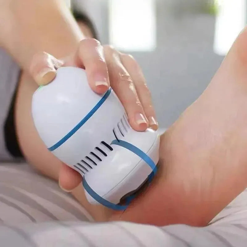 Automatic Callus Remover"