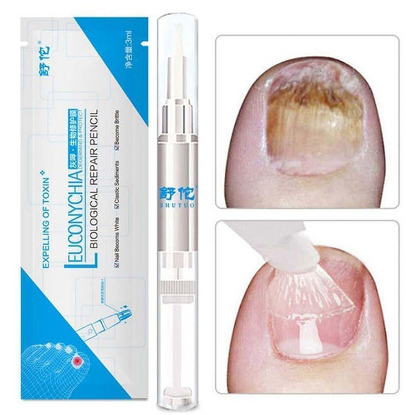 7-DAY Fungal Nail Repair Pen