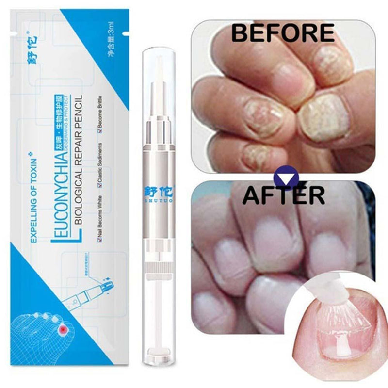 7-DAY Fungal Nail Repair Pen