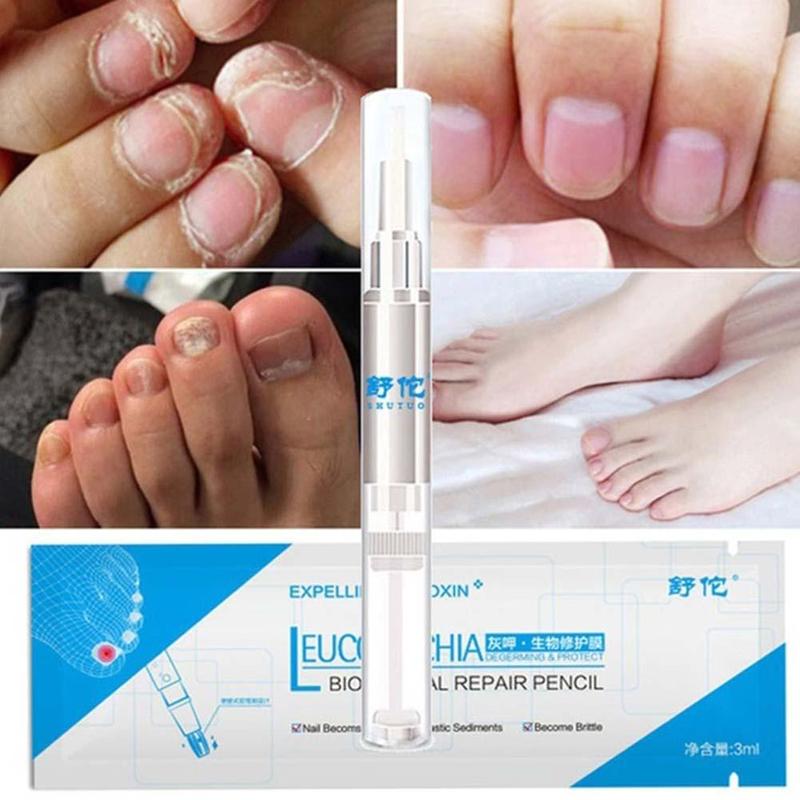 7-DAY Fungal Nail Repair Pen