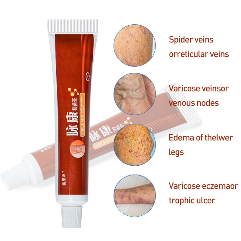 Varicose Veins Miracle Cream (Original Product)