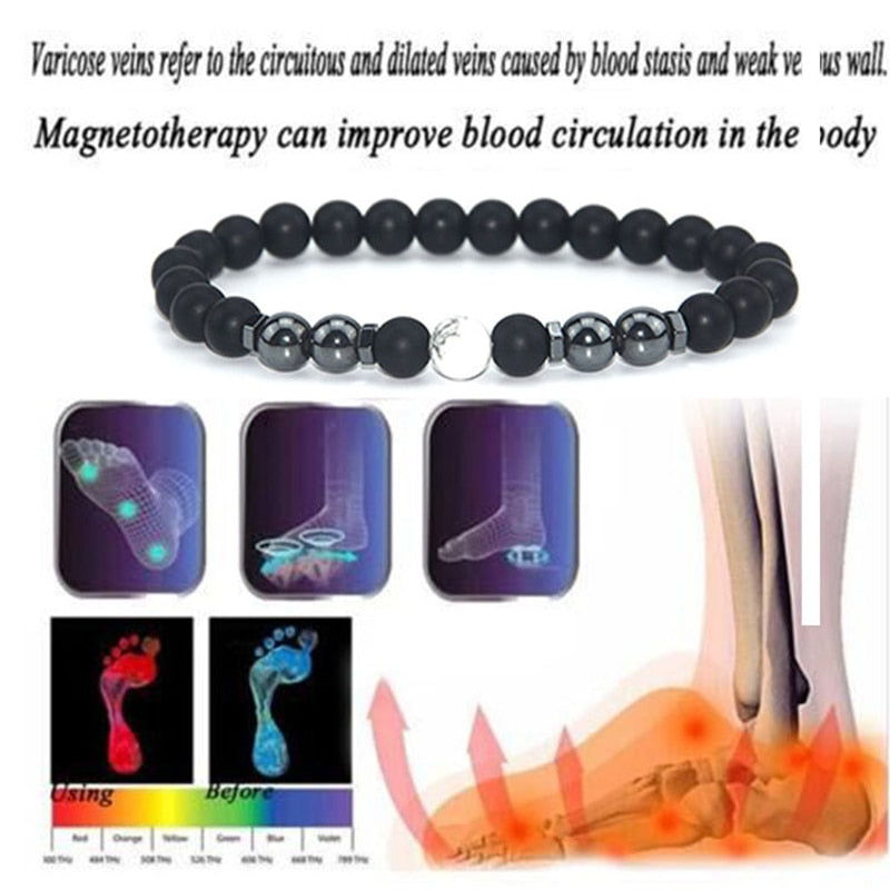 Anti Varicose And Swelling Magnetotherapy Anklet