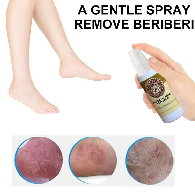 Anti-Fungal Treatment Spray