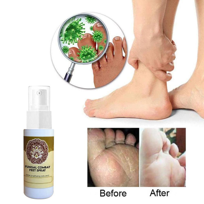 Anti-Fungal Treatment Spray