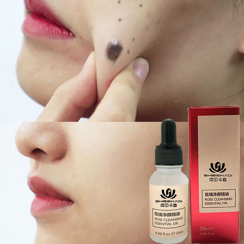 Organic Skin Spot Solution Serum