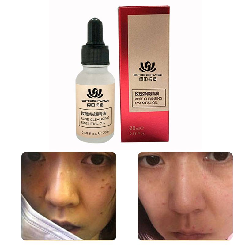 Organic Skin Spot Solution Serum