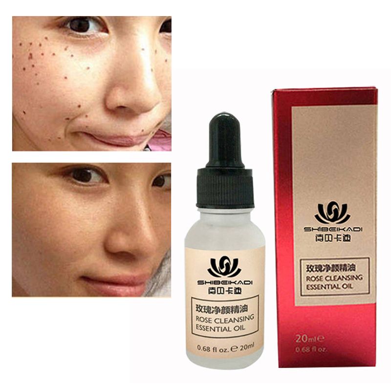 Organic Skin Spot Solution Serum