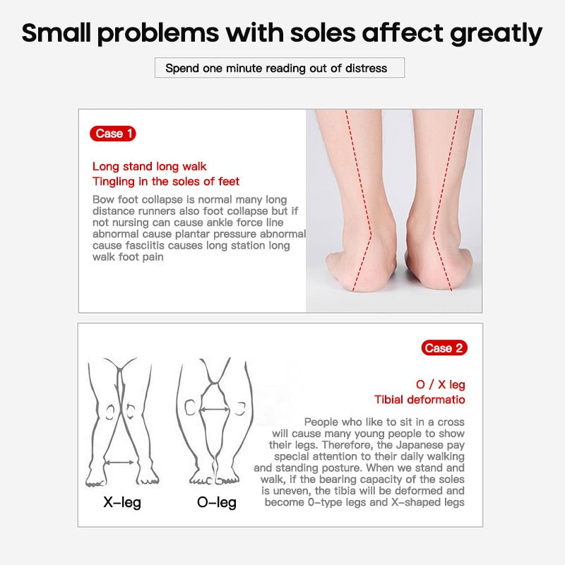 Flat Foot Orthopedic Insoles