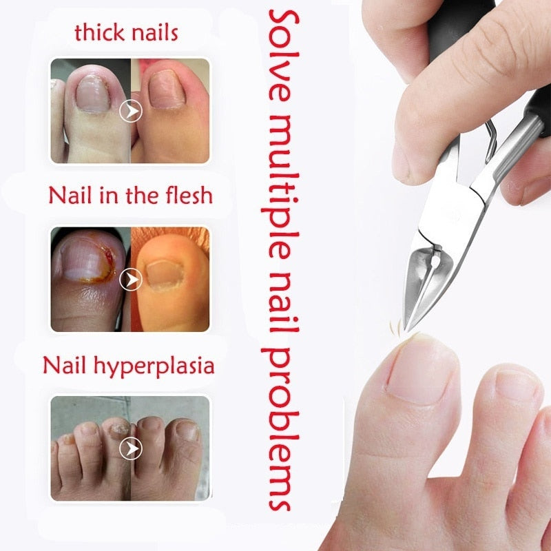 Medical-grade Nail Clipper