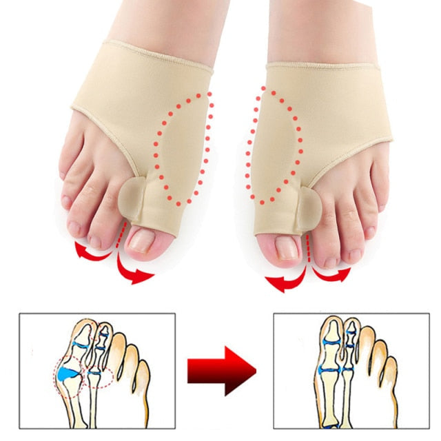 Dr.Fit Bunion Corrector Sleeve