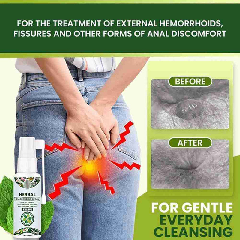 Herbal Hemorrhoid Spray